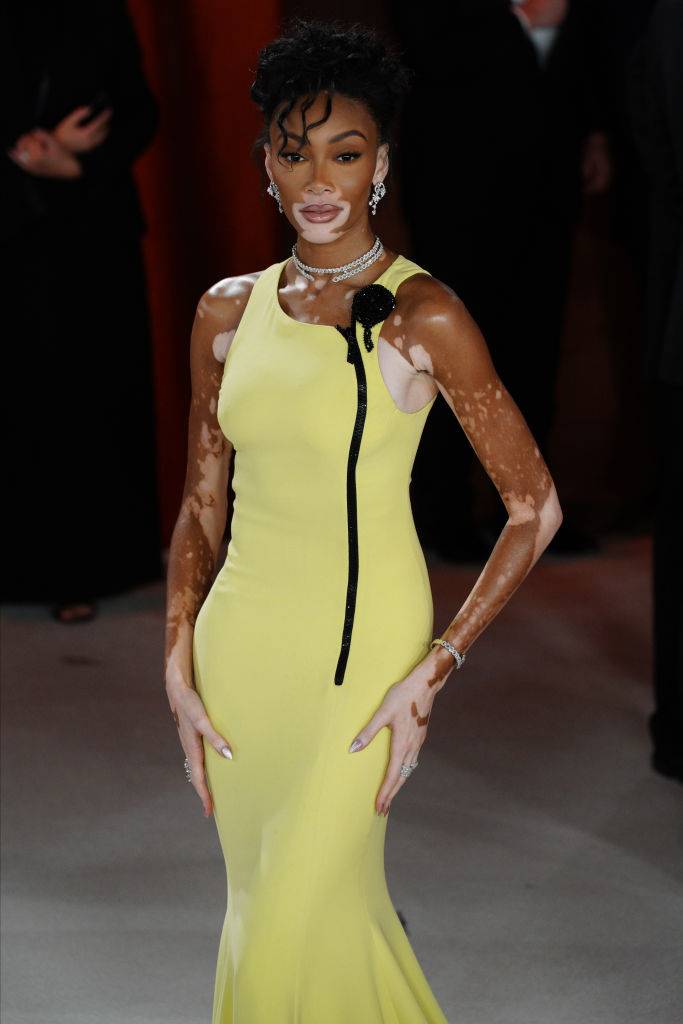 Winnie Harlow, Fot. Getty Images