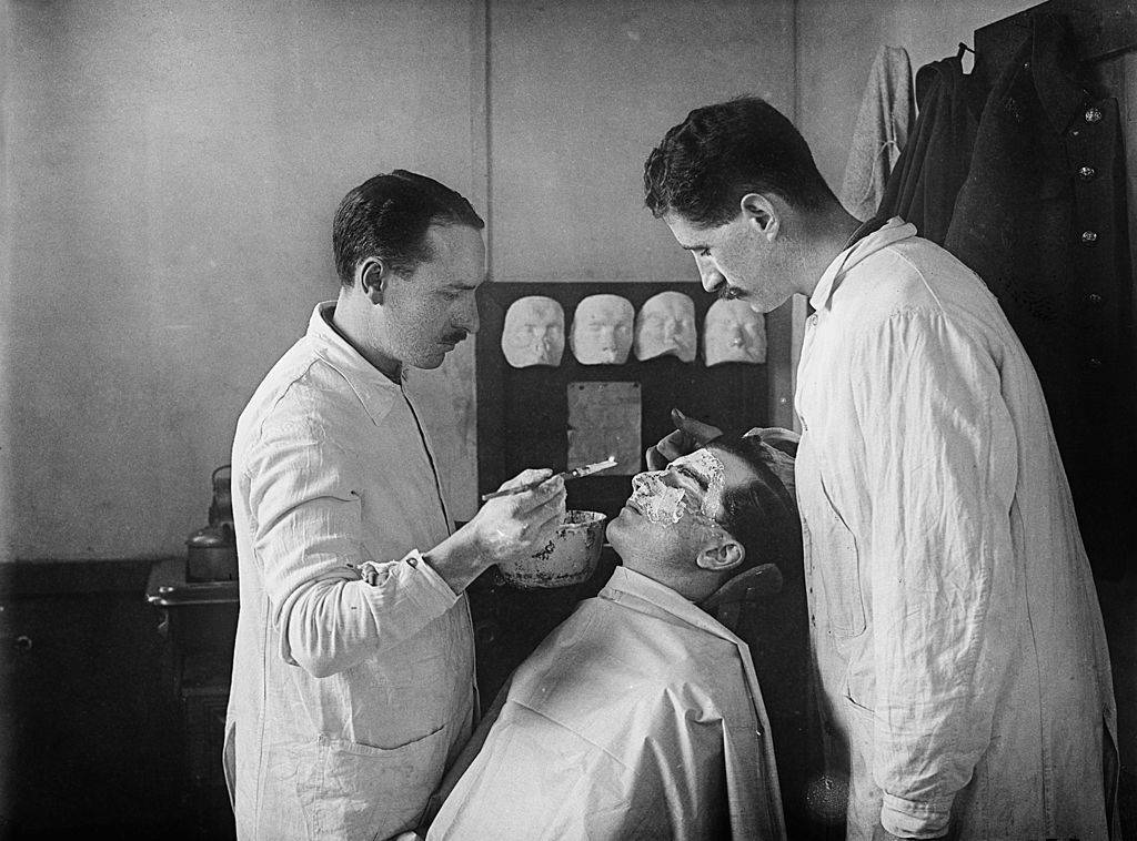 Asystenci kapitana Francisa Derwenta Wooda z III London General Hospital zakrywają gipsem twarz pacjenta . Z twarzy pacjenta wykonywana jest forma, dzięki której można stworzyć maskę,zakrywającą jego obrażenia. ok.1916 r. (Fot.Horace Nicholls/Imperial War Museums, via Getty Images)